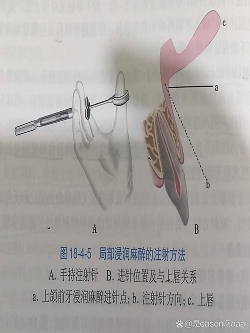 麻醉学专业好不好就业_麻醉学专业前景-第4张图片-职教招生网