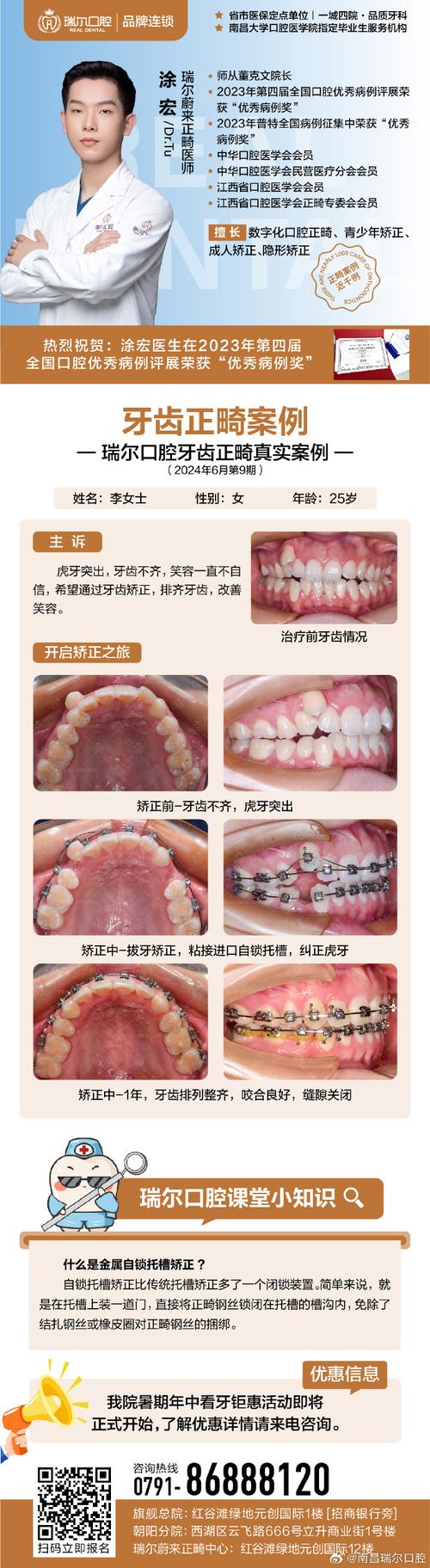 口腔医学正畸专业_口腔医学正畸专业代码-第3张图片-职教招生网 口腔医学正畸专业_口腔医学正畸专业代码-第3张图片-职教招生网